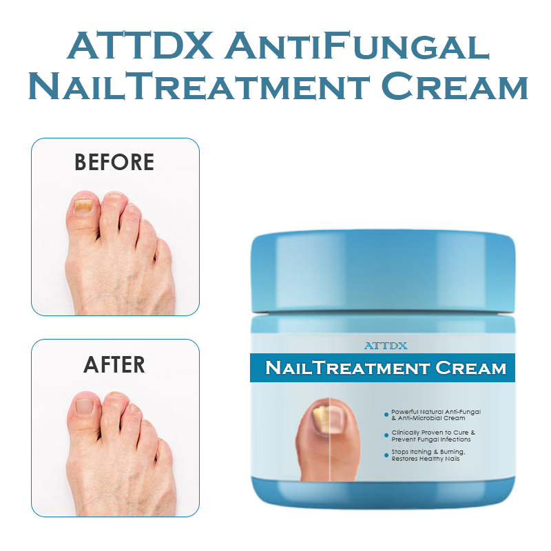 ATTDX AntiFungal NailTreatment Cream