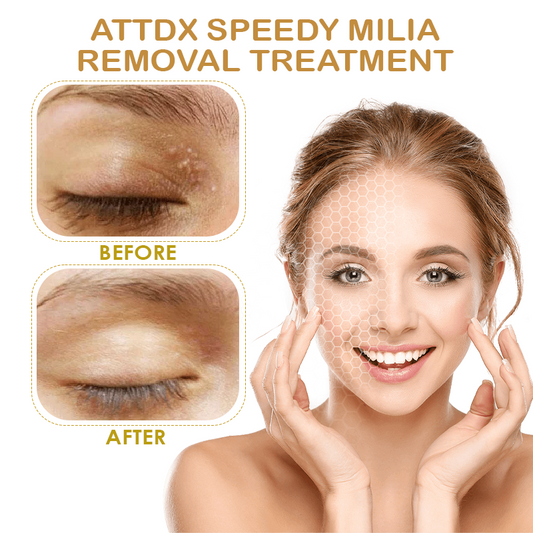 ATTDX Speedy Milia Removal Treatment